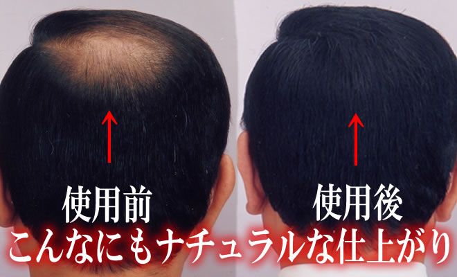 増毛スプレー・育毛・養毛・発毛専門店 アクアライフ 使用前・使用後